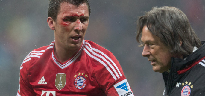 Marin MANDZUKIC (FC Bayern) with blood on his face is treated by FCB Dr. Hans-Wilhelm MUELLER-WOHLFAHRT -- photo: dpa